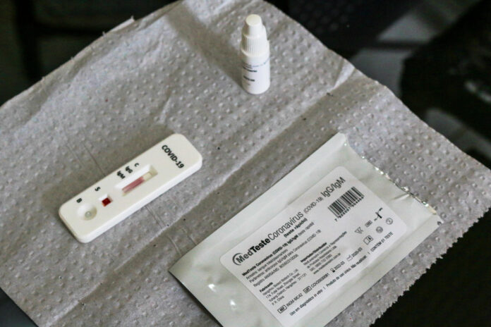 Aprovado uso de testes rápidos de coronavírus em farmácias